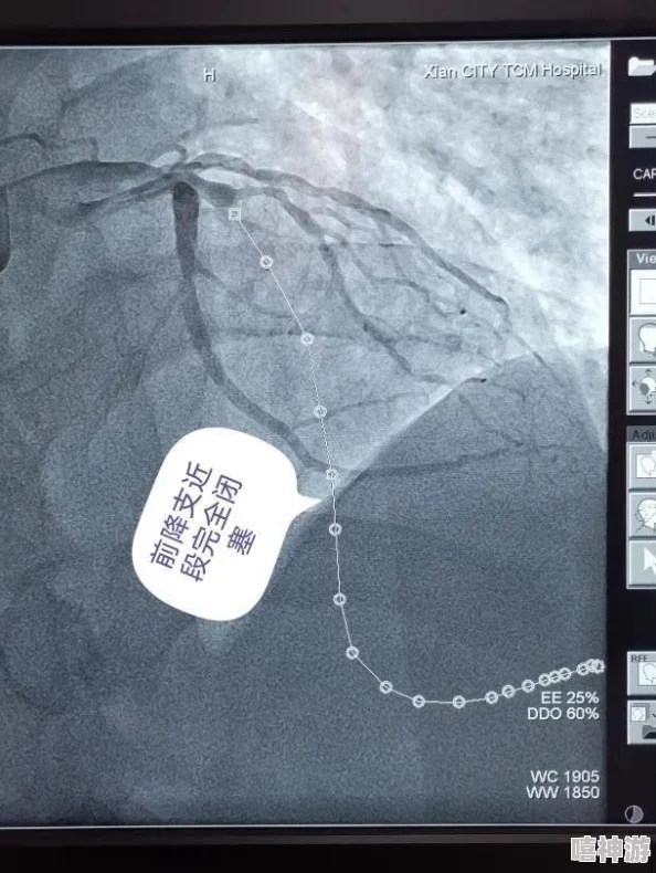 兄弟之间如何互相导管该话题涉及敏感内容，建议寻找其他健康积极的互动方式